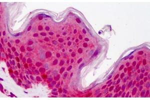 Human Skin: Formalin-Fixed, Paraffin-Embedded (FFPE) (YWHAB 抗体  (AA 34-221))
