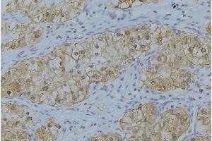 Immunohistochemistry (IHC) image for anti-Collagen, Type V, alpha 1 (COL5A1) (Internal Region) antibody (ABIN6257109)