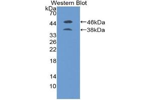 Western blot analysis of the recombinant protein. (PLGF 抗体  (AA 19-158))