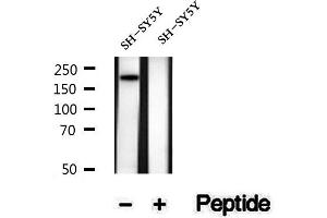 Western blot analysis of extracts of SH-SY5Y cells, using Phospho-Tuberin/TSC2 (Ser1387) Antibody.