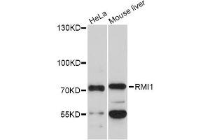 Western blot analysis of extracts of various cell lines, using RMI1 Antibody (ABIN5972890) at 1/1000 dilution. (RMI1 抗体)