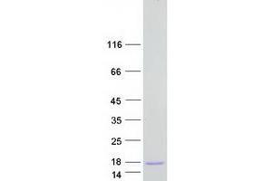 Western Blotting (WB) image for Caspase Recruitment Domain-Containing Protein 18 (ICEBERG) (CARD18) protein (Myc-DYKDDDDK Tag) (ABIN2713164)