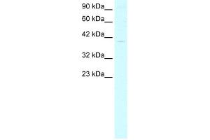 WB Suggested Anti-GTF2B Antibody Titration:  4. (GTF2B 抗体  (N-Term))