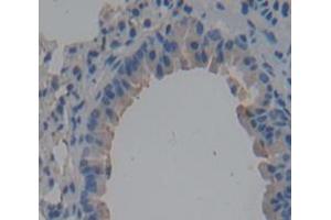 Used in DAB staining on fromalin fixed paraffin- embedded Kidney tissue (CD101 抗体  (AA 302-531))