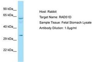 Image no. 1 for anti-RAD51 Homolog D (RAD51D) (AA 259-308) antibody (ABIN6749950) (RAD51D 抗体  (AA 259-308))