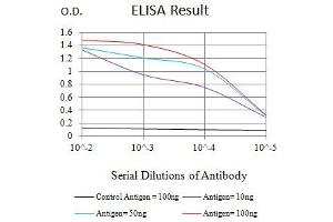 Black line: Control Antigen (100 ng),Purple line: Antigen (10 ng), Blue line: Antigen (50 ng), Red line:Antigen (100 ng) (TUBB3 抗体)