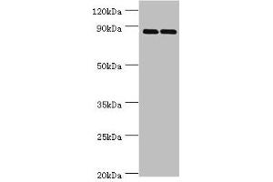 Western blot All lanes: SET and MYND domain-containing protein 4 antibody at 4 μg/mL Lane 1: HepG2 whole cell lysate Lane 2: Hela whole cell lysate Secondary Goat polyclonal to rabbit IgG at 1/10000 dilution Predicted band size: 89 kDa Observed band size: 89 kDa (SMYD4 抗体  (AA 1-260))