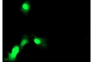 Anti-EXOSC7 mouse monoclonal antibody (ABIN2455505) immunofluorescent staining of COS7 cells transiently transfected by pCMV6-ENTRY EXOSC7 (RC201419). (EXOSC7 抗体)