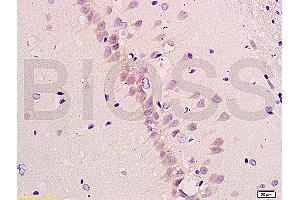 Formalin-fixed and paraffin embedded rat brain tissue labeled with Anti-beta-Amyloid 1-40 (CT) Polyclonal Antibody, Unconjugated (ABIN729328) at 1:200, followed by conjugation to the secondary antibody and DAB staining (Abeta 1-40 抗体  (C-Term))