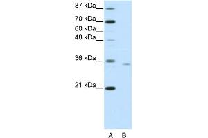 WB Suggested Anti-OTP Antibody Titration:  0. (OTP 抗体  (C-Term))