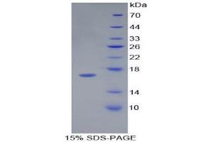 SDS-PAGE (SDS) image for Desert Hedgehog (DHH) (AA 241-383) protein (His tag) (ABIN1879055) (desert Hedgehog Protein (AA 241-383) (His tag))