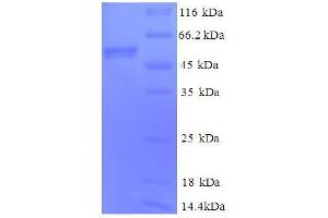 SDS-PAGE (SDS) image for Cytochrome C1 (CYC1) (AA 85-325), (full length) protein (GST tag) (ABIN7479241)