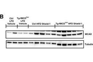 MCD induction suppresses the fatty acid oxidative pathway. (Medium-Chain Specific Acyl-CoA Dehydrogenase, Mitochondrial (MCAD) (Center) 抗体)