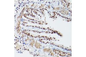 Immunohistochemistry of paraffin-embedded mouse lung using PSME3 Rabbit pAb (ABIN6135015, ABIN6146357, ABIN6146358 and ABIN6216428) at dilution of 1:100 (40x lens). (PSME3 抗体  (C-Term))