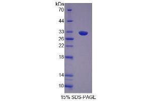 SDS-PAGE analysis of Human OS9 Protein. (OS9 蛋白)