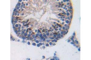 Used in DAB staining on fromalin fixed paraffin- embedded Kidney tissue (SPA17 抗体  (AA 1-143))