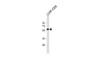 Anti-SLC22A6 Antibody (C-Term) at 1:1000 dilution + CCRF-CEM whole cell lysate Lysates/proteins at 20 μg per lane. (SLC22A6 抗体  (C-Term))