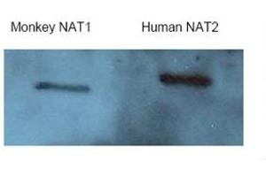 Western Blotting (WB) image for anti-N-Acetyltransferase 2 (Arylamine N-Acetyltransferase) (NAT2) (Middle Region) antibody (ABIN2781757) (NAT2 抗体  (Middle Region))