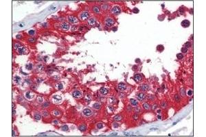 Immunohistochemistry (IHC) image for anti-Glucose-6-Phosphate Dehydrogenase (G6PD) (AA 35-506) antibody (ABIN400862) (Glucose-6-Phosphate Dehydrogenase 抗体  (AA 35-506))
