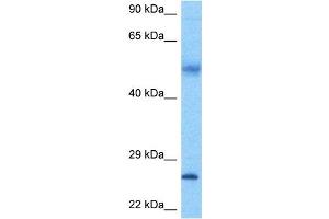 Host:  Rabbit  Target Name:  FAM3A  Sample Tissue:  Human Ovary Tumor lysates  Antibody Dilution:  1ug/ml