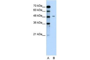 Chromogranin A antibody used at 0. (Chromogranin A 抗体)