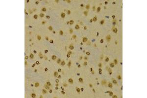Immunohistochemistry (IHC) image for anti-Histone 3 (H3) (H3K9me3) antibody (ABIN3016030)