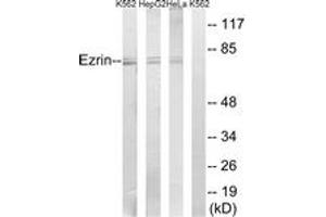 Western blot analysis of extracts from HeLa/HepG2/K562 cells, using Ezrin (Ab-146) Antibody. (Ezrin 抗体  (AA 111-160))
