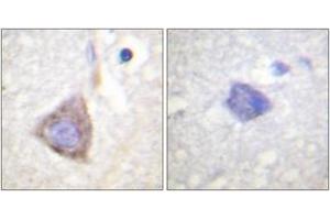 Immunohistochemistry (IHC) image for anti-Breakpoint Cluster Region (BCR) (AA 331-380) antibody (ABIN2888761) (BCR 抗体  (AA 331-380))