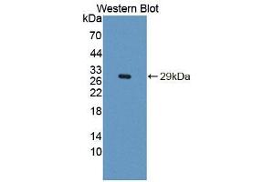 Western blot analysis of the recombinant protein. (IRS4 抗体  (AA 1-196))