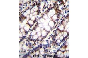 UQCRFS1 Antibody (C-term) immunohistochemistry analysis in formalin fixed and paraffin embedded human rectum tissue followed by peroxidase conjugation of the secondary antibody and DAB staining. (UQCRFS1 (Complex III Subunit Rieske) (AA 188-217), (C-Term) 抗体)