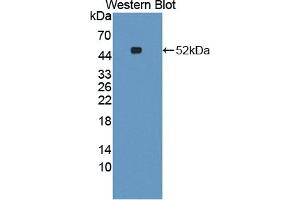Western blot analysis of the recombinant protein. (CCBL1 抗体  (AA 1-422))
