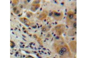 Used in DAB staining on fromalin fixed paraffin-embedded Liver tissue (IFNA2 抗体  (AA 24-188))