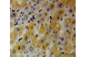 IHC-P analysis of Liver tissue, with DAB staining. (PHLDA2 抗体  (AA 1-152))