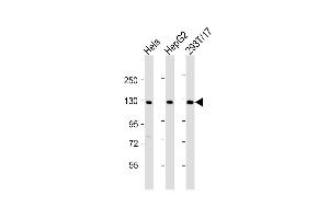 Western Blot at 1:2000 dilution Lane 1: Hela whole cell lysate Lane 2: HepG2 whole cell lysate Lane 3: 293T/17 whole cell lysate Lysates/proteins at 20 ug per lane. (LRIG3 抗体  (AA 23-54))