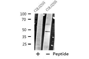 Western blot analysis of extracts from COLO205 cells using CRHR2 antibody. (CRHR2 抗体  (Internal Region))