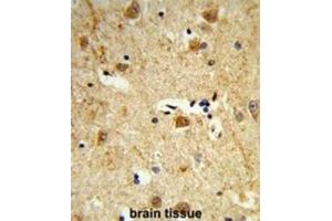 Immunohistochemistry (IHC) image for anti-Dolichol Kinase (DOLK) antibody (ABIN3003934) (Dolichol Kinase 抗体)