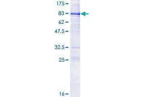 Image no. 1 for Cytotoxic and Regulatory T Cell Molecule (CRTAM) (AA 1-393) protein (GST tag) (ABIN1350400)