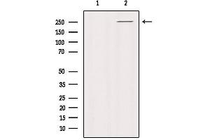 Western Blotting (WB) image for anti-Protein tyrosine Phosphatase, Receptor-Type, Z Polypeptide 1 (PTPRZ1) (N-Term) antibody (ABIN6259162)