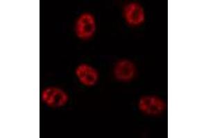 ABIN6272425 staining 293 by IF/ICC. (SCAF1 抗体  (N-Term))