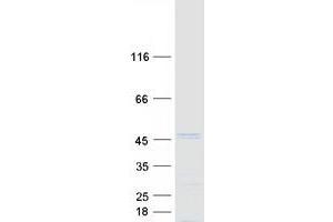 Western Blotting (WB) image for Speckle-Type POZ Protein (SPOP-B) (Transcript Variant 6) protein (Myc-DYKDDDDK Tag) (ABIN2732612)