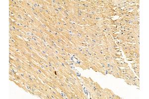 Phospho-IL4R/CD124 (Tyr497) Antibody at 1/100 staining Rat heart tissue by IHC-P. (IL4 Receptor 抗体  (pTyr497))