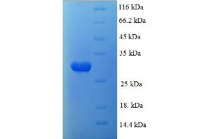 SDS-PAGE (SDS) image for phosphoserine Aminotransferase 1 (PSAT1) (AA 1-251), (partial) protein (His tag) (ABIN5710169)