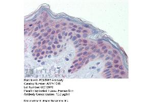Immunohistochemistry (IHC) image for anti-Polymerase (DNA-Directed), delta Interacting Protein 3 (POLDIP3) (C-Term) antibody (ABIN2776594)