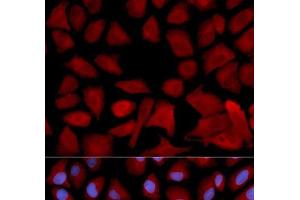 Immunofluorescence analysis of U2OS cells using PSMC4 Polyclonal Antibody (PSMC4 抗体)