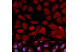 Immunofluorescence analysis of U2OS cells using PSMC4 Polyclonal Antibody (PSMC4 抗体)