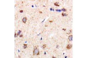 Immunohistochemical analysis of CHMP1B staining in rat brain formalin fixed paraffin embedded tissue section. (CHMP1B 抗体)