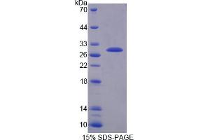 Image no. 1 for Transmembrane Protease, serine 2 (TMPRSS2) (AA 254-490) protein (His tag) (ABIN6237811) (TMPRSS2 Protein (AA 254-490) (His tag))