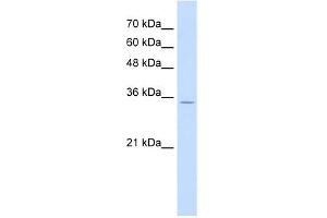 WB Suggested Anti-RNF39 Antibody Titration:  0. (RNF39 抗体  (N-Term))