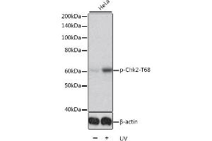 Western blot analysis of extracts of HeLa cells, using Phospho-Chk2-T68 antibody (ABIN6135202, ABIN6136046, ABIN6136047 and ABIN6225610). (CHEK2 抗体  (pThr68))
