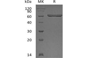 Galectin 9 Protein (GST tag)